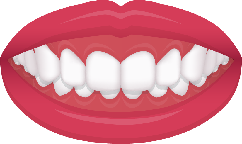 Deep bite and open bite