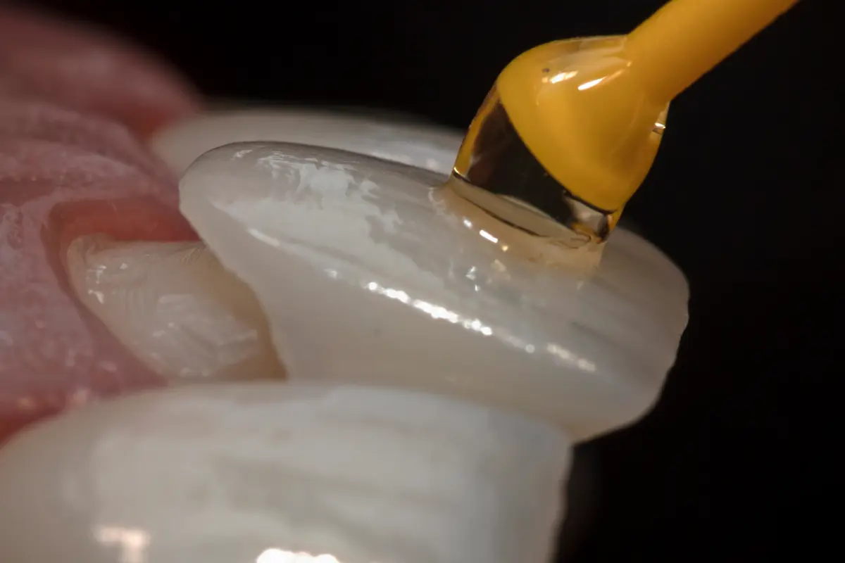 Dental veneers at Primadent, Liverpool