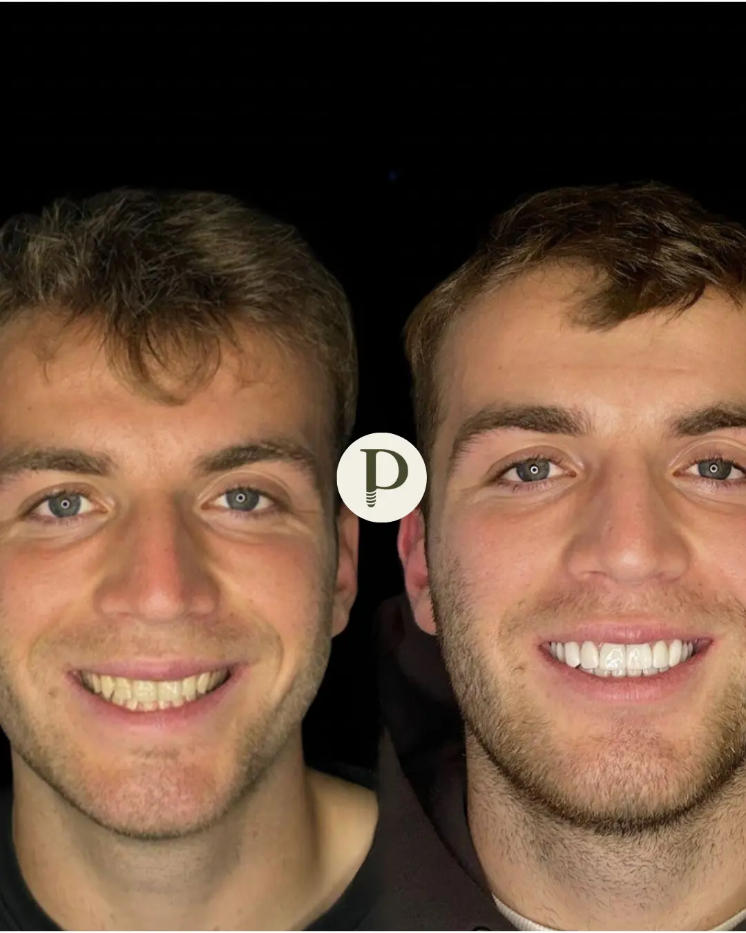 A smile makeover consultation at Primadent, Liverpool