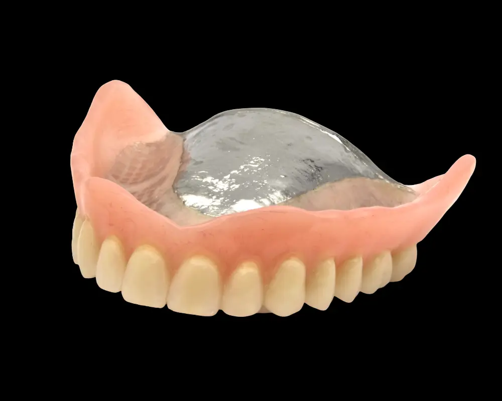 Full metal-based denture at Primadent, Liverpool