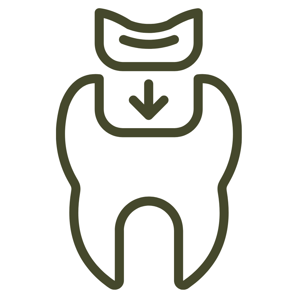 Lost filling or crown