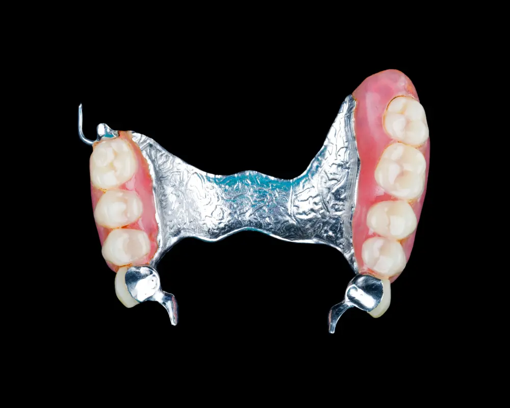 Partial metal denture at Primadent, Liverpool