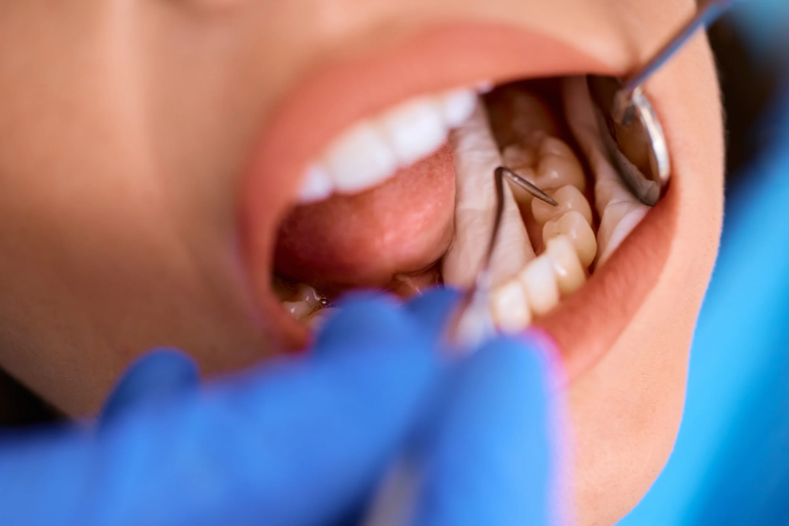 A relaxed patient at Primadent, Liverpool, having a tooth-coloured filling