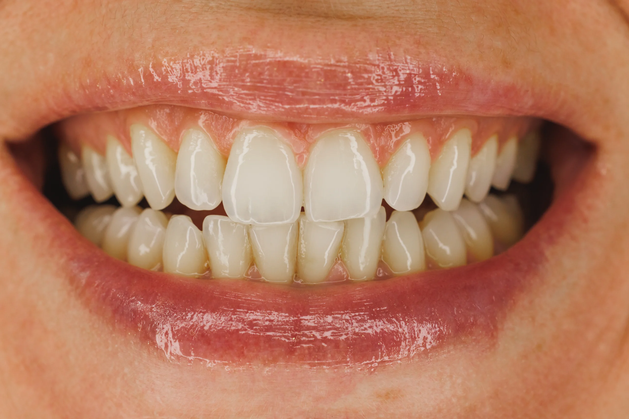A relaxed patient at Primadent, Liverpool, during gum disease treatment