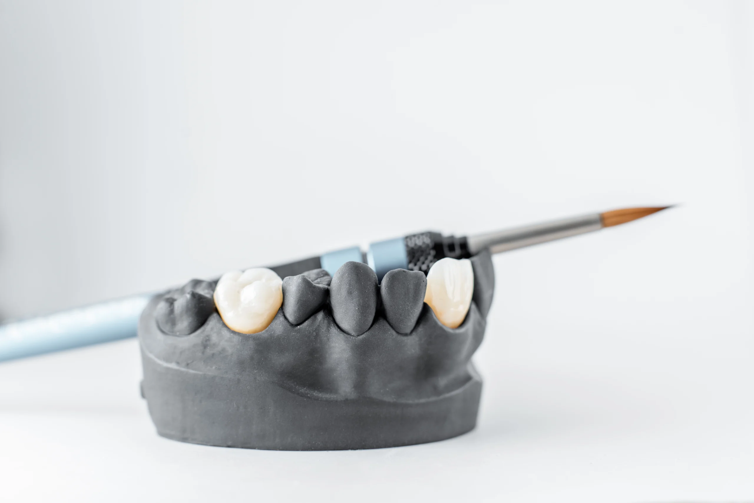 Dental crowns at Primadent, Liverpool